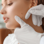 Dermatologia: quando e perché rivolgersi al dermatologo